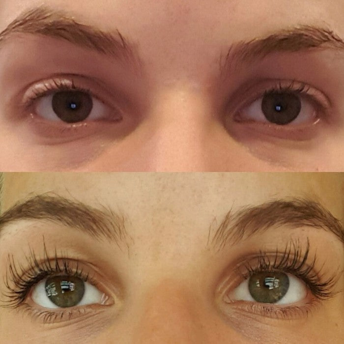 Resultatbillede af Tolure Hairplus Bryn Serum 3 ml med før- og eftervisning.